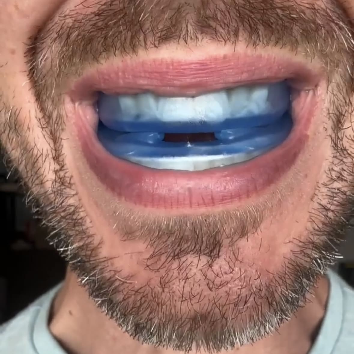 DAVEYA™ Anti-Snurk Mondstuk