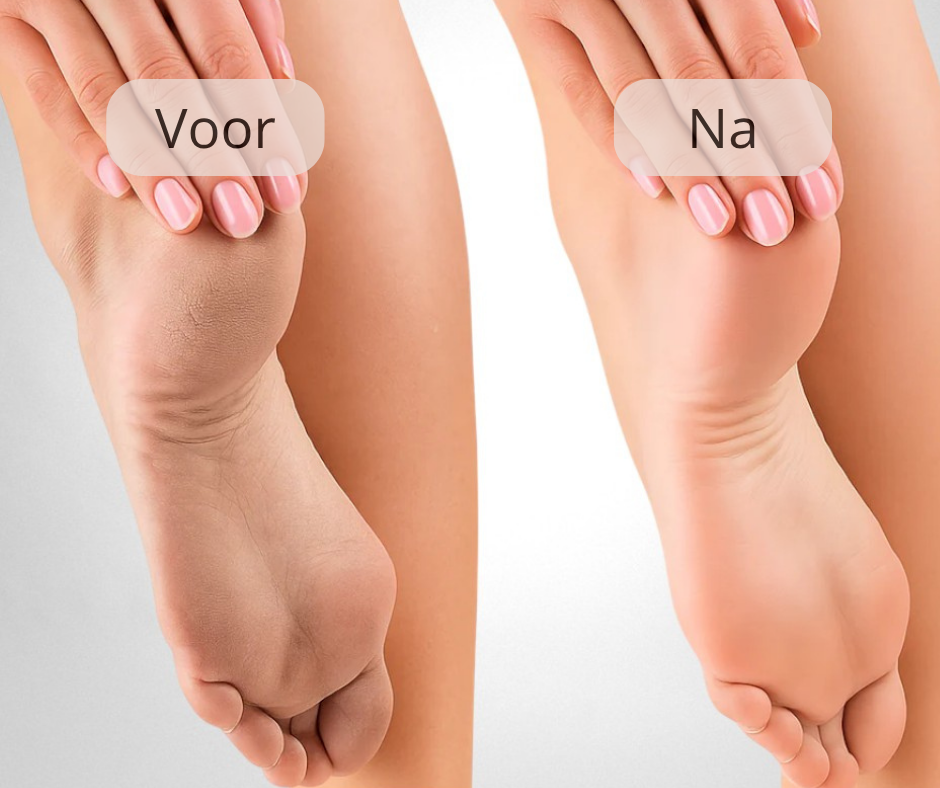 ZachteVoeten